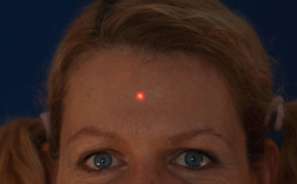 Woman with red laser dot on face